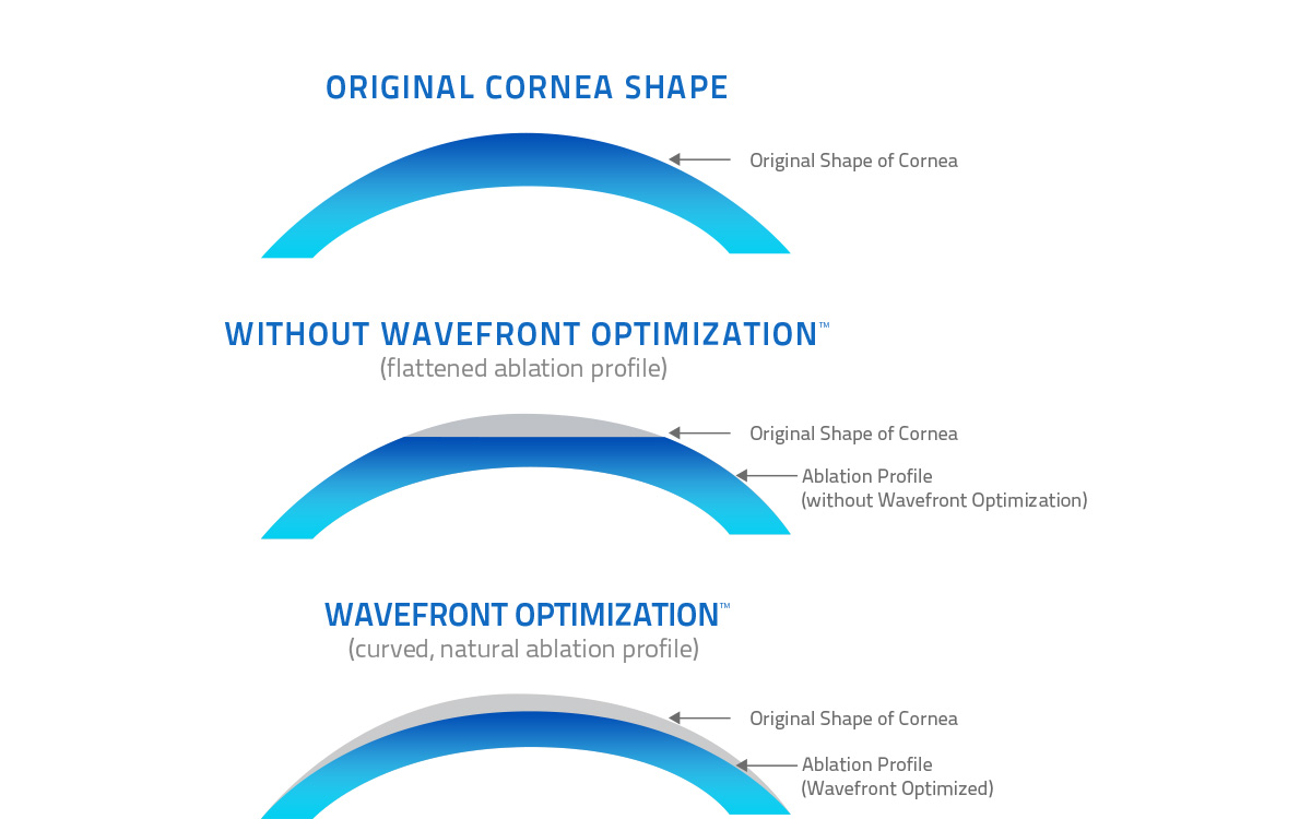 Wavefront-Illustration-Colby-Stewart-MD-Houston-Texas-LASIK-Vision-Correction.jpg